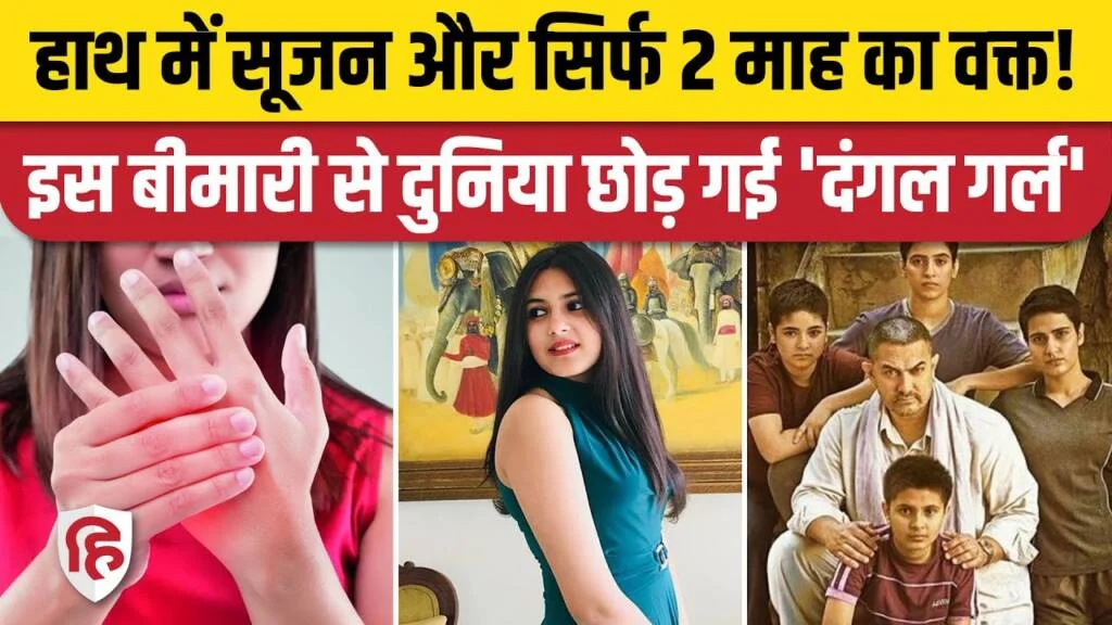 Suhani Bhatnagar Death